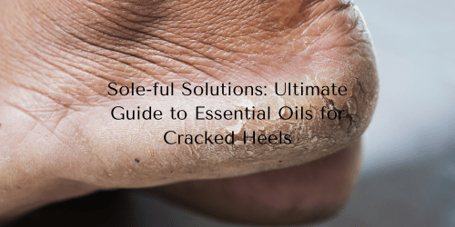 Sole-ful Solutions: Ultimate Guide to Essential Oils for Cracked Heels