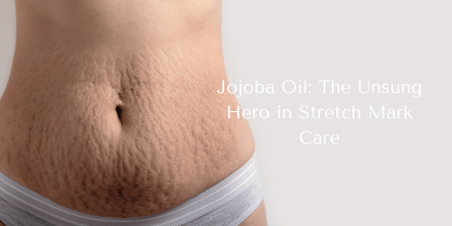 Jojoba Oil: The Unsung Hero in Stretch Mark Care