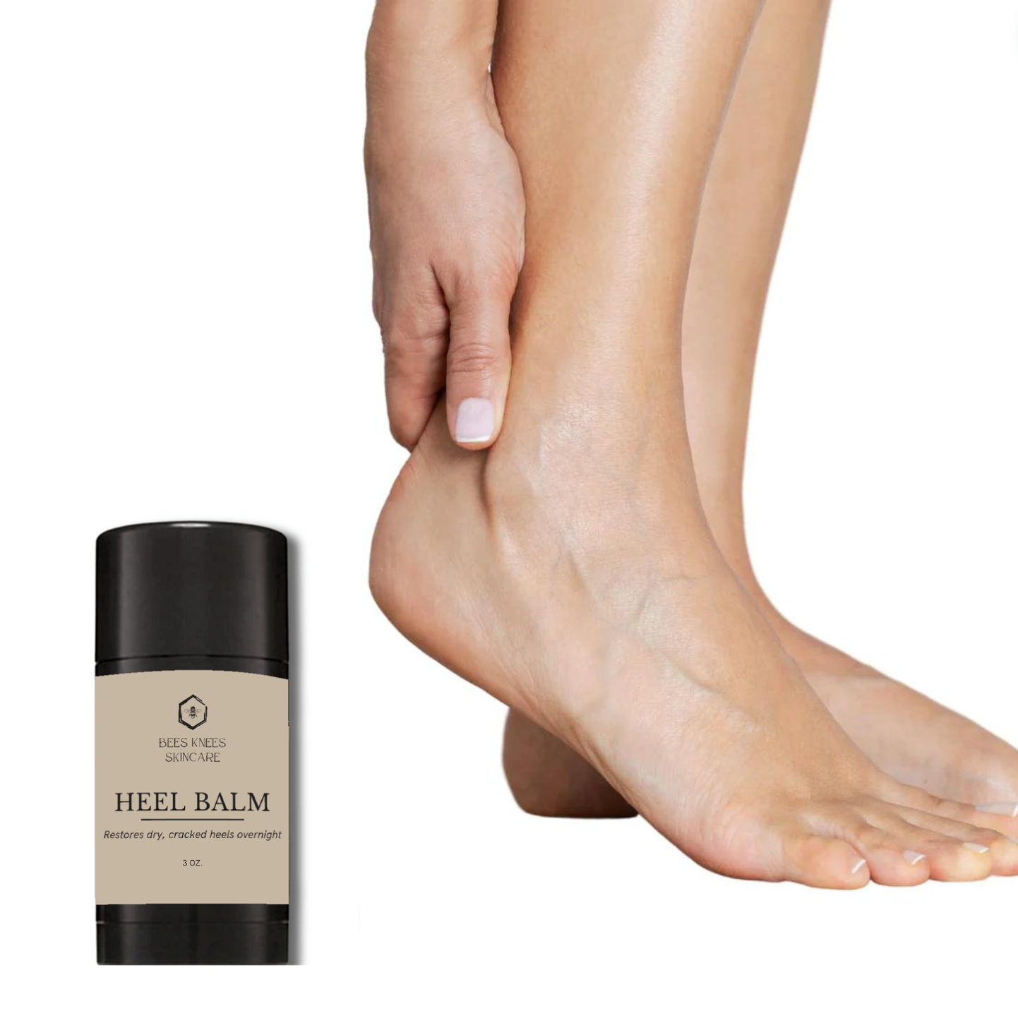 Head Over Heels- Cracked Heel Treatment & Foot Repair Balm